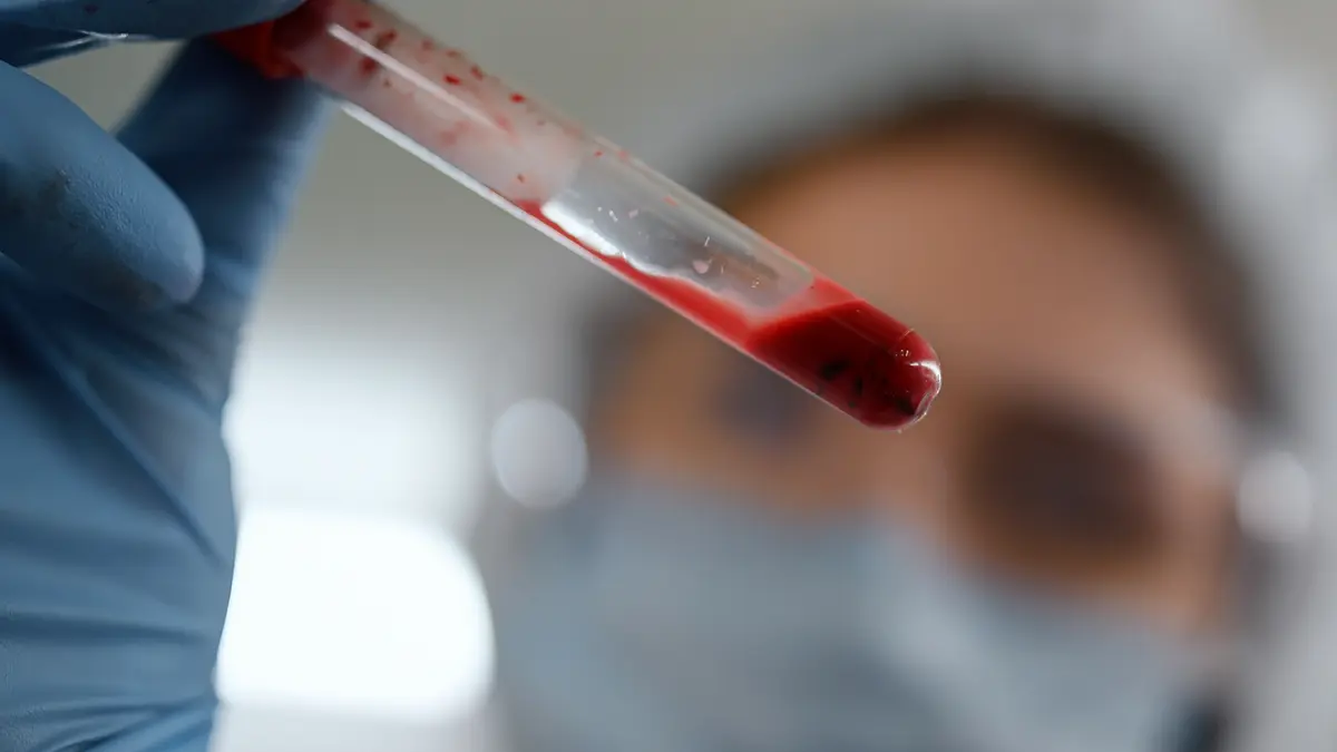 Prodia Batam: Alamat, Layanan Lab dan Medical Check-Up, Cara Pesan